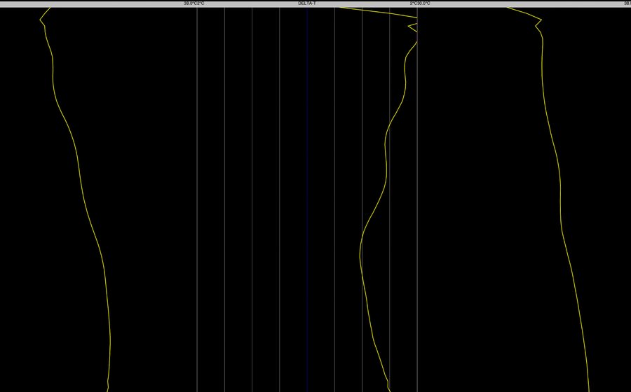 Temperature scan graph comparing the left and right sides of the spine