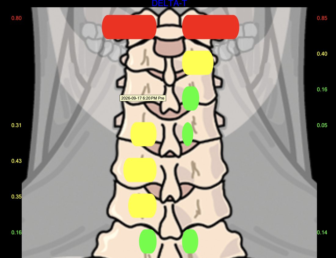 Temperature scan of the neck, with colored markers showing readings at each level of the spine